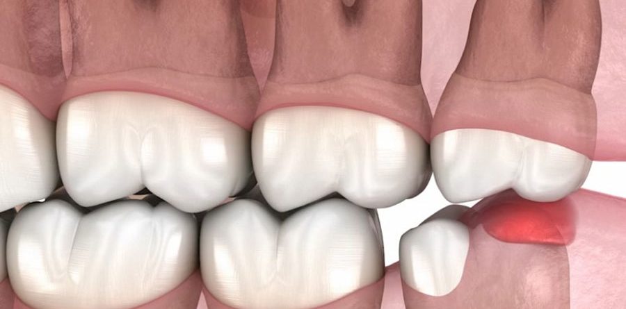 Zobna kirurgija Luxdental